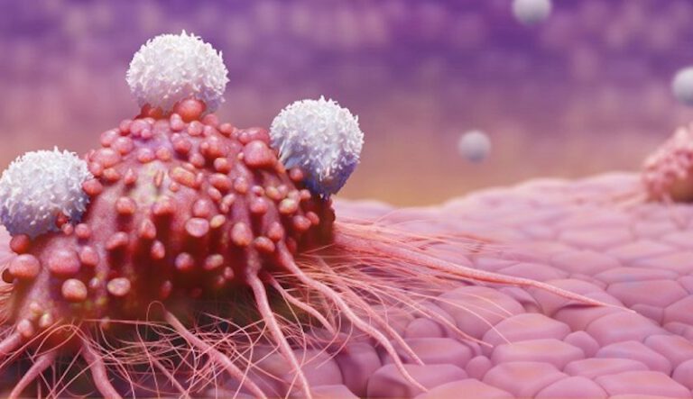 Đột phá mới nhất trong điều trị ung thư: tế bào CAR-T